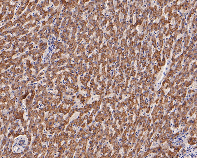 Paraformaldehyde-fixed, paraffin embedded Human liver; Antigen retrieval by boiling in sodium citrate buffer (pH6.0) for 15min; Block endogenous peroxidase by 3% hydrogen peroxide for 20 minutes; Blocking buffer (normal goat serum) at 37°C for 30min; Antibody incubation with GOT2 Monoclonal Antibody, Unconjugated (bsm-54731R) at 1:200 for 30 minutes at room temperature, DAB staining.