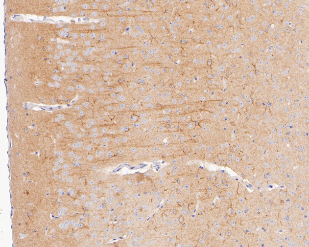Paraformaldehyde-fixed, paraffin embedded Mouse brain; Antigen retrieval by boiling in sodium citrate buffer (pH6.0) for 15min; Block endogenous peroxidase by 3% hydrogen peroxide for 20 minutes; Blocking buffer (normal goat serum) at 37°C for 30min; Antibody incubation with KLC1 Monoclonal Antibody, Unconjugated (bsm-54732R) at 1:400 for 30 minutes at room temperature, DAB staining.