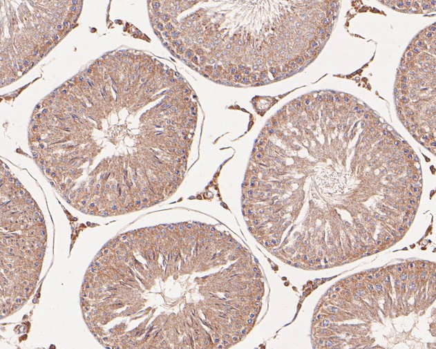 Paraformaldehyde-fixed, paraffin embedded Rat testis; Antigen retrieval by boiling in sodium citrate buffer (pH6.0) for 15min; Block endogenous peroxidase by 3% hydrogen peroxide for 20 minutes; Blocking buffer (normal goat serum) at 37°C for 30min; Antibody incubation with KLC1 Monoclonal Antibody, Unconjugated (bsm-54732R) at 1:50 for 30 minutes at room temperature, DAB staining.