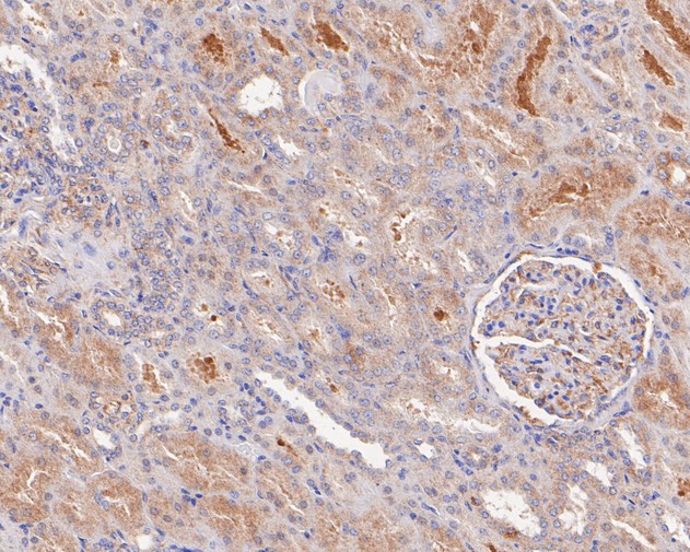 Paraformaldehyde-fixed, paraffin embedded Human kidney; Antigen retrieval by boiling in sodium citrate buffer (pH6.0) for 15min; Block endogenous peroxidase by 3% hydrogen peroxide for 20 minutes; Blocking buffer (normal goat serum) at 37°C for 30min; Antibody incubation with KLC1 Monoclonal Antibody, Unconjugated (bsm-54732R) at 1:200 for 30 minutes at room temperature, DAB staining.