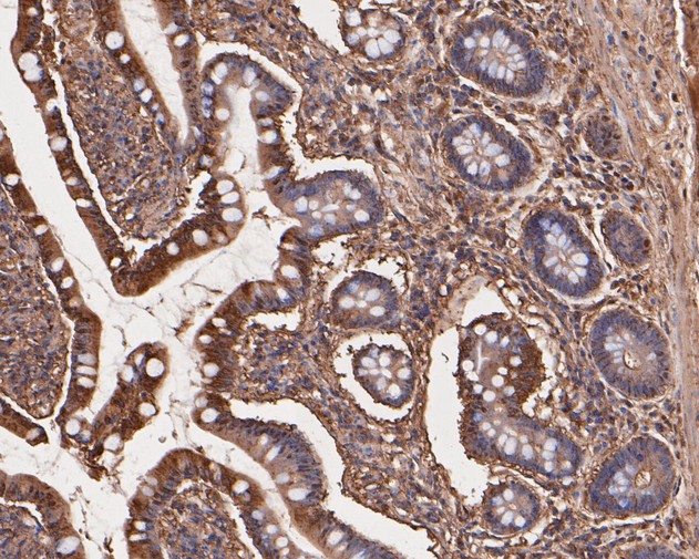 Paraformaldehyde-fixed, paraffin embedded Human intestine; Antigen retrieval by boiling in sodium citrate buffer (pH6.0) for 15min; Block endogenous peroxidase by 3% hydrogen peroxide for 20 minutes; Blocking buffer (normal goat serum) at 37°C for 30min; Antibody incubation with TNFRSF19 Monoclonal Antibody, Unconjugated (bsm-54733R) at 1:50 for 30 minutes at room temperature, DAB staining.