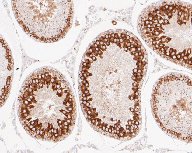 Paraformaldehyde-fixed, paraffin embedded Rat testis; Antigen retrieval by boiling in sodium citrate buffer (pH6.0) for 15min; Block endogenous peroxidase by 3% hydrogen peroxide for 20 minutes; Blocking buffer (normal goat serum) at 37°C for 30min; Antibody incubation with APLP2 Monoclonal Antibody, Unconjugated (bsm-54736R) at 1:50 for 30 minutes at room temperature, DAB staining.