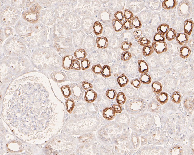Paraformaldehyde-fixed, paraffin embedded Human kidney; Antigen retrieval by boiling in sodium citrate buffer (pH6.0) for 15min; Block endogenous peroxidase by 3% hydrogen peroxide for 20 minutes; Blocking buffer (normal goat serum) at 37°C for 30min; Antibody incubation with APLP2 Monoclonal Antibody, Unconjugated (bsm-54736R) at 1:50 for 30 minutes at room temperature, DAB staining.