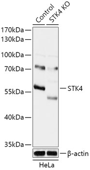 Lane 1: Hela cell lysates; Lane 2: STK4 knockout (KO) HeLa cell lysates probed with STK4 Polyclonal Antibody, Unconjugated (bs-55209R) at 1:1000 dilution and 4˚C overnight incubation. Followed by conjugated secondary antibody incubation at 1:20000 for 60 min at 37˚C.