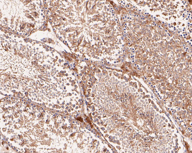 Paraformaldehyde-fixed, paraffin embedded Mouse testis; Antigen retrieval by boiling in sodium citrate buffer (pH6.0) for 15min; Block endogenous peroxidase by 3% hydrogen peroxide for 20 minutes; Blocking buffer (normal goat serum) at 37°C for 30min; Antibody incubation with VEGFD Monoclonal Antibody, Unconjugated (bsm-54739R) at 1:50 for 30 minutes at room temperature, DAB staining.