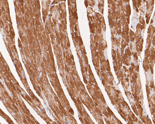 Paraformaldehyde-fixed, paraffin embedded Mouse heart; Antigen retrieval by boiling in sodium citrate buffer (pH6.0) for 15min; Block endogenous peroxidase by 3% hydrogen peroxide for 20 minutes; Blocking buffer (normal goat serum) at 37°C for 30min; Antibody incubation with VEGFD Monoclonal Antibody, Unconjugated (bsm-54739R) at 1:200 for 30 minutes at room temperature, DAB staining.