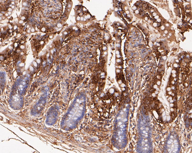 Paraformaldehyde-fixed, paraffin embedded Human intestine; Antigen retrieval by boiling in sodium citrate buffer (pH6.0) for 15min; Block endogenous peroxidase by 3% hydrogen peroxide for 20 minutes; Blocking buffer (normal goat serum) at 37°C for 30min; Antibody incubation with VEGFD Monoclonal Antibody, Unconjugated (bsm-54739R) at 1:200 for 30 minutes at room temperature, DAB staining.