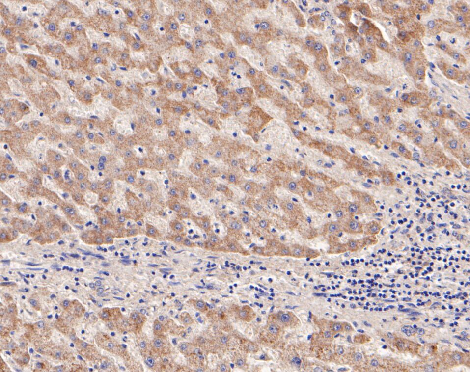 Paraformaldehyde-fixed, paraffin embedded Human liver; Antigen retrieval by boiling in sodium citrate buffer (pH6.0) for 15min; Block endogenous peroxidase by 3% hydrogen peroxide for 20 minutes; Blocking buffer (normal goat serum) at 37°C for 30min; Antibody incubation with DPYD Monoclonal Antibody, Unconjugated (bsm-54740R) at 1:200 for 30 minutes at room temperature, DAB staining.