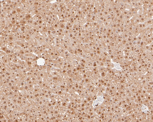 Paraformaldehyde-fixed, paraffin embedded Mouse liver; Antigen retrieval by boiling in sodium citrate buffer (pH6.0) for 15min; Block endogenous peroxidase by 3% hydrogen peroxide for 20 minutes; Blocking buffer (normal goat serum) at 37°C for 30min; Antibody incubation with NFYA Monoclonal Antibody, Unconjugated (bsm-54741R) at 1:100 for 30 minutes at room temperature, DAB staining.