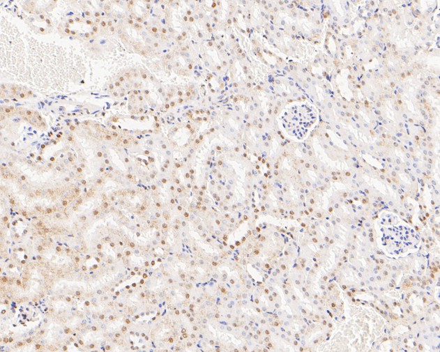Paraformaldehyde-fixed, paraffin embedded Mouse kidney; Antigen retrieval by boiling in sodium citrate buffer (pH6.0) for 15min; Block endogenous peroxidase by 3% hydrogen peroxide for 20 minutes; Blocking buffer (normal goat serum) at 37°C for 30min; Antibody incubation with NFYA Monoclonal Antibody, Unconjugated (bsm-54741R) at 1:500 for 30 minutes at room temperature, DAB staining.