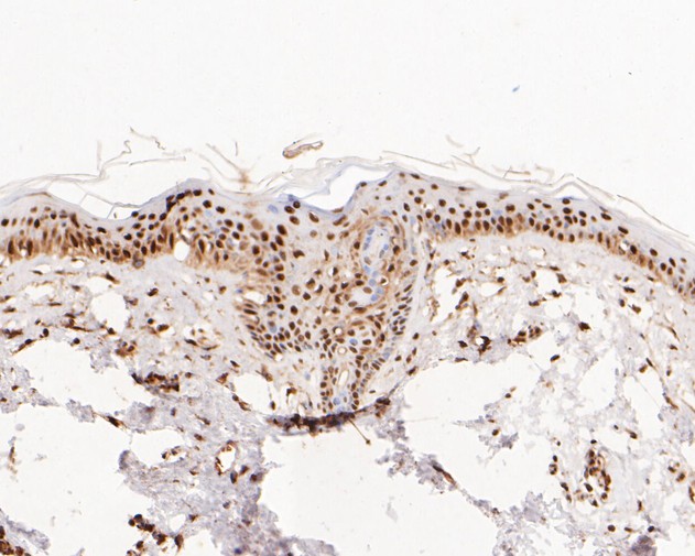 Paraformaldehyde-fixed, paraffin embedded Human skin; Antigen retrieval by boiling in sodium citrate buffer (pH6.0) for 15min; Block endogenous peroxidase by 3% hydrogen peroxide for 20 minutes; Blocking buffer (normal goat serum) at 37°C for 30min; Antibody incubation with NFYA Monoclonal Antibody, Unconjugated (bsm-54741R) at 1:100 for 30 minutes at room temperature, DAB staining.