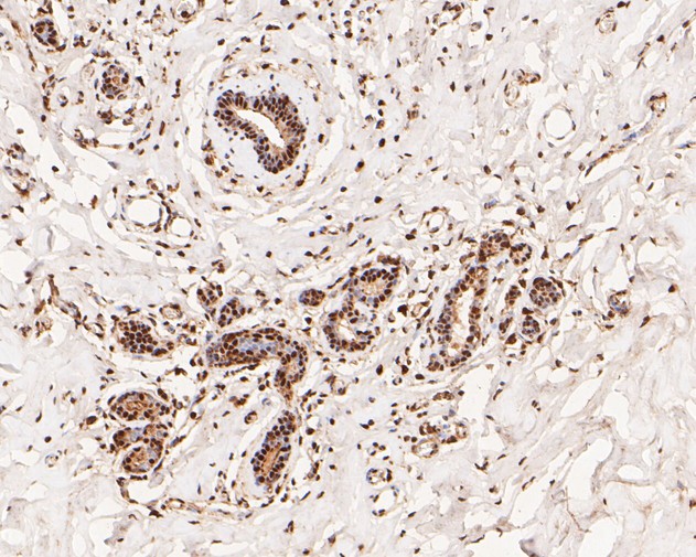 Paraformaldehyde-fixed, paraffin embedded Human breast; Antigen retrieval by boiling in sodium citrate buffer (pH6.0) for 15min; Block endogenous peroxidase by 3% hydrogen peroxide for 20 minutes; Blocking buffer (normal goat serum) at 37°C for 30min; Antibody incubation with NFYA Monoclonal Antibody, Unconjugated (bsm-54741R) at 1:100 for 30 minutes at room temperature, DAB staining.