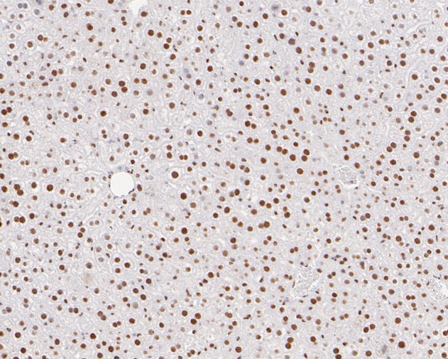 Paraformaldehyde-fixed, paraffin embedded Mouse liver; Antigen retrieval by boiling in sodium citrate buffer (pH6.0) for 15min; Block endogenous peroxidase by 3% hydrogen peroxide for 20 minutes; Blocking buffer (normal goat serum) at 37°C for 30min; Antibody incubation with Tat-SF1 Monoclonal Antibody, Unconjugated (bsm-54743R) at 1:100 for 30 minutes at room temperature, DAB staining.