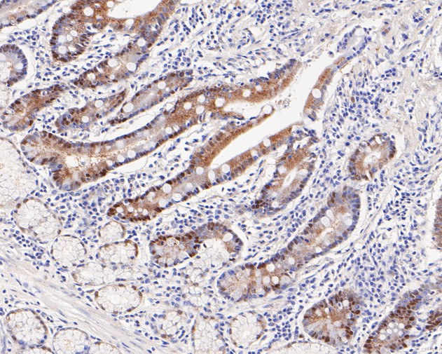 Paraformaldehyde-fixed, paraffin embedded Human intestine; Antigen retrieval by boiling in sodium citrate buffer (pH6.0) for 15min; Block endogenous peroxidase by 3% hydrogen peroxide for 20 minutes; Blocking buffer (normal goat serum) at 37°C for 30min; Antibody incubation with PEX19 Monoclonal Antibody, Unconjugated (bsm-54745R) at 1:100 for 30 minutes at room temperature, DAB staining.