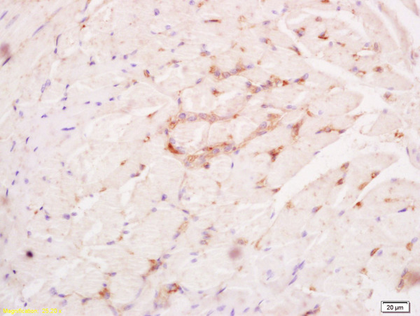 Formalin-fixed and paraffin embedded rat tongue tissue labeled with Anti PHOSPHO-FGFR1 (TYR307) Polyclonal antibody,Unconjugated (bs-5325R) at 1:200 followed by conjugation to the secondary antibody and DAB staining.