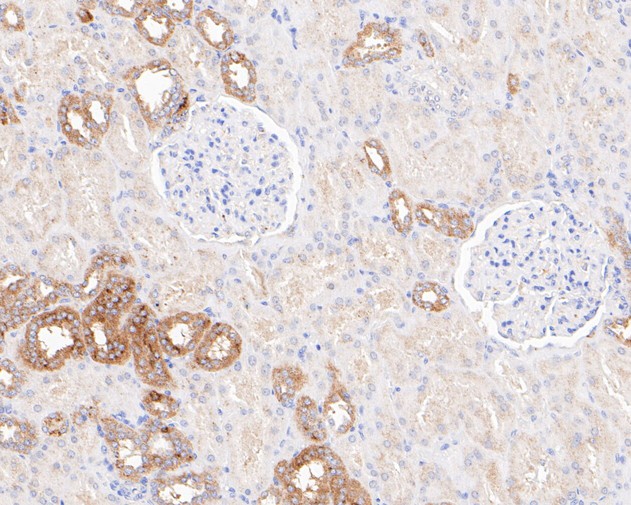 Paraformaldehyde-fixed, paraffin embedded Human kidney; Antigen retrieval by boiling in sodium citrate buffer (pH6.0) for 15min; Block endogenous peroxidase by 3% hydrogen peroxide for 20 minutes; Blocking buffer (normal goat serum) at 37°C for 30min; Antibody incubation with Arg2 Monoclonal Antibody, Unconjugated (bsm-54747R) at 1:200 for 30 minutes at room temperature, DAB staining.