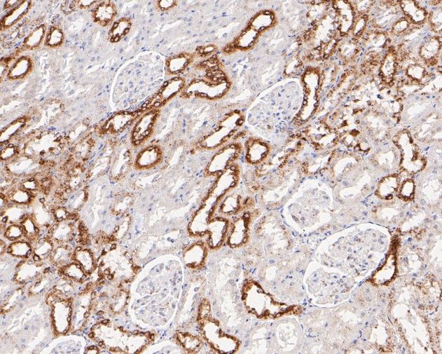 Paraformaldehyde-fixed, paraffin embedded Rat kidney; Antigen retrieval by boiling in sodium citrate buffer (pH6.0) for 15min; Block endogenous peroxidase by 3% hydrogen peroxide for 20 minutes; Blocking buffer (normal goat serum) at 37°C for 30min; Antibody incubation with P4HB Monoclonal Antibody, Unconjugated (bsm-54748R) at 1:50 for 30 minutes at room temperature, DAB staining.