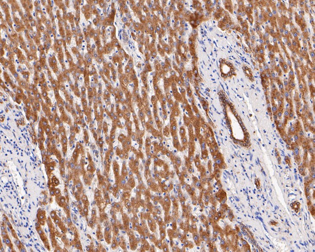 Paraformaldehyde-fixed, paraffin embedded Human liver; Antigen retrieval by boiling in sodium citrate buffer (pH6.0) for 15min; Block endogenous peroxidase by 3% hydrogen peroxide for 20 minutes; Blocking buffer (normal goat serum) at 37°C for 30min; Antibody incubation with P4HB Monoclonal Antibody, Unconjugated (bsm-54748R) at 1:200 for 30 minutes at room temperature, DAB staining.