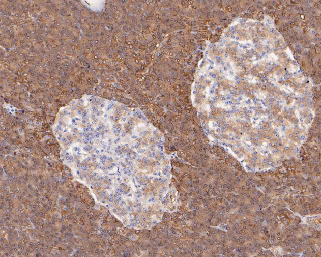 Paraformaldehyde-fixed, paraffin embedded Human pancreas; Antigen retrieval by boiling in sodium citrate buffer (pH6.0) for 15min; Block endogenous peroxidase by 3% hydrogen peroxide for 20 minutes; Blocking buffer (normal goat serum) at 37°C for 30min; Antibody incubation with P4HB Monoclonal Antibody, Unconjugated (bsm-54748R) at 1:200 for 30 minutes at room temperature, DAB staining.
