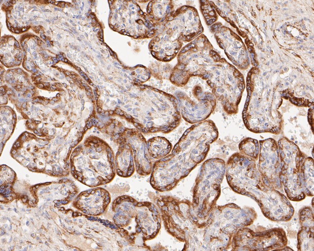 Paraformaldehyde-fixed, paraffin embedded Human placenta; Antigen retrieval by boiling in sodium citrate buffer (pH6.0) for 15min; Block endogenous peroxidase by 3% hydrogen peroxide for 20 minutes; Blocking buffer (normal goat serum) at 37°C for 30min; Antibody incubation with P4HB Monoclonal Antibody, Unconjugated (bsm-54748R) at 1:50 for 30 minutes at room temperature, DAB staining.