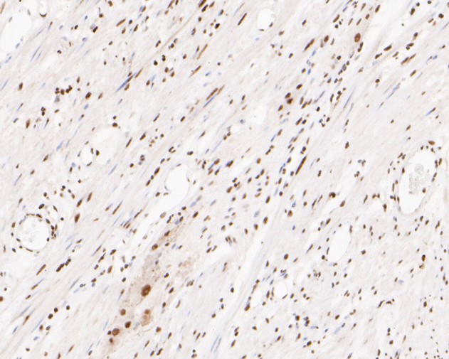 Paraformaldehyde-fixed, paraffin embedded Human smooth muscle; Antigen retrieval by boiling in sodium citrate buffer (pH6.0) for 15min; Block endogenous peroxidase by 3% hydrogen peroxide for 20 minutes; Blocking buffer (normal goat serum) at 37°C for 30min; Antibody incubation with XPD Monoclonal Antibody, Unconjugated (bsm-54749R) at 1:200 for 30 minutes at room temperature, DAB staining.