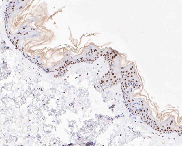 Paraformaldehyde-fixed, paraffin embedded Human skin; Antigen retrieval by boiling in sodium citrate buffer (pH6.0) for 15min; Block endogenous peroxidase by 3% hydrogen peroxide for 20 minutes; Blocking buffer (normal goat serum) at 37°C for 30min; Antibody incubation with XPD Monoclonal Antibody, Unconjugated (bsm-54749R) at 1:200 for 30 minutes at room temperature, DAB staining.