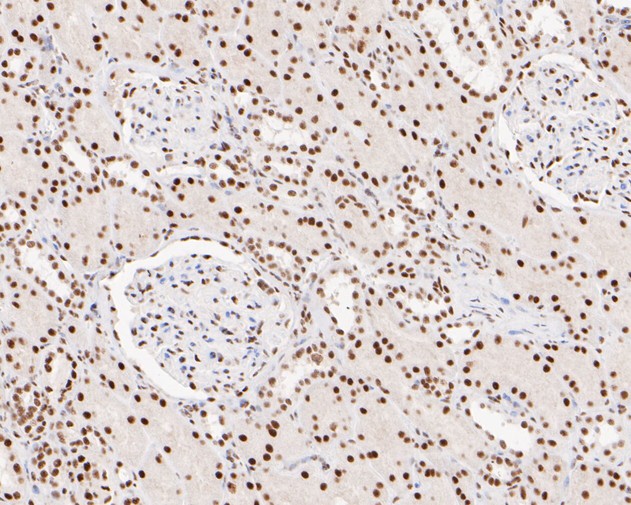 Paraformaldehyde-fixed, paraffin embedded Human kidney; Antigen retrieval by boiling in sodium citrate buffer (pH6.0) for 15min; Block endogenous peroxidase by 3% hydrogen peroxide for 20 minutes; Blocking buffer (normal goat serum) at 37°C for 30min; Antibody incubation with XPD Monoclonal Antibody, Unconjugated (bsm-54749R) at 1:200 for 30 minutes at room temperature, DAB staining.