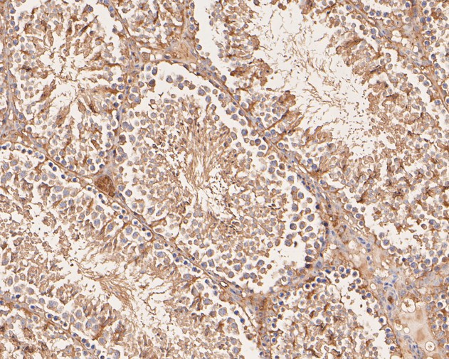 Paraformaldehyde-fixed, paraffin embedded Mouse testis; Antigen retrieval by boiling in sodium citrate buffer (pH6.0) for 15min; Block endogenous peroxidase by 3% hydrogen peroxide for 20 minutes; Blocking buffer (normal goat serum) at 37°C for 30min; Antibody incubation with VPS28 Monoclonal Antibody, Unconjugated (bsm-54750R) at 1:50 for 30 minutes at room temperature, DAB staining.