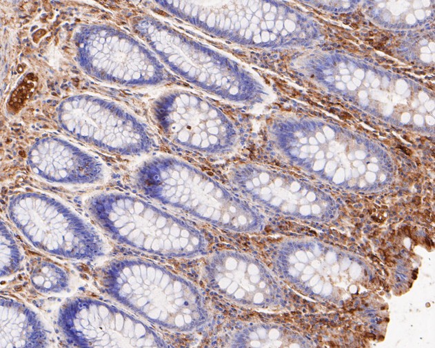 Paraformaldehyde-fixed, paraffin embedded Human colon; Antigen retrieval by boiling in sodium citrate buffer (pH6.0) for 15min; Block endogenous peroxidase by 3% hydrogen peroxide for 20 minutes; Blocking buffer (normal goat serum) at 37°C for 30min; Antibody incubation with VPS28 Monoclonal Antibody, Unconjugated (bsm-54750R) at 1:200 for 30 minutes at room temperature, DAB staining.