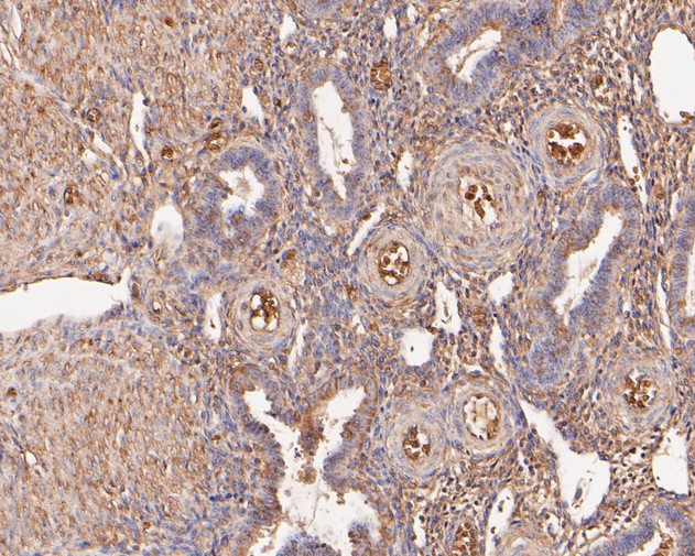 Paraformaldehyde-fixed, paraffin embedded Human uterus; Antigen retrieval by boiling in sodium citrate buffer (pH6.0) for 15min; Block endogenous peroxidase by 3% hydrogen peroxide for 20 minutes; Blocking buffer (normal goat serum) at 37°C for 30min; Antibody incubation with VPS28 Monoclonal Antibody, Unconjugated (bsm-54750R) at 1:200 for 30 minutes at room temperature, DAB staining.