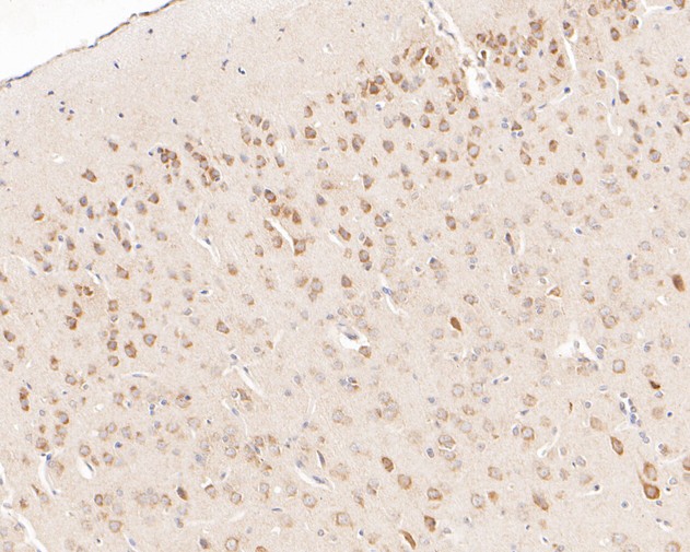 Paraformaldehyde-fixed, paraffin embedded Rat brain; Antigen retrieval by boiling in sodium citrate buffer (pH6.0) for 15min; Block endogenous peroxidase by 3% hydrogen peroxide for 20 minutes; Blocking buffer (normal goat serum) at 37°C for 30min; Antibody incubation with LMAN1 Monoclonal Antibody, Unconjugated (bsm-54753R) at 1:50 for 30 minutes at room temperature, DAB staining.
