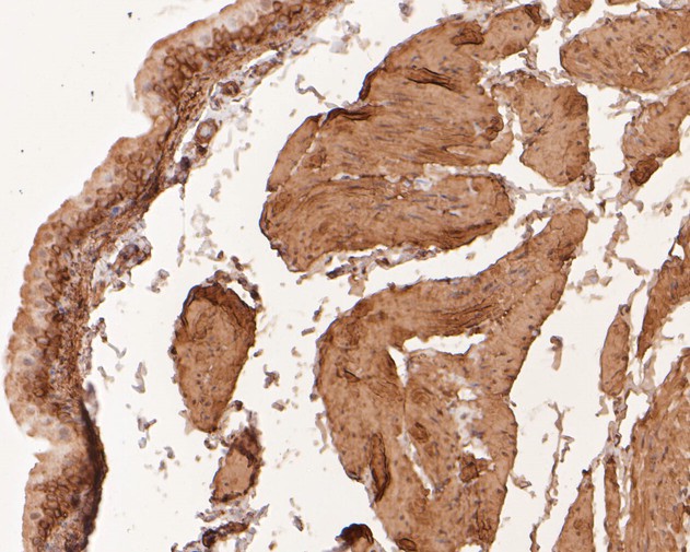Paraformaldehyde-fixed, paraffin embedded Rat bladder; Antigen retrieval by boiling in sodium citrate buffer (pH6.0) for 15min; Block endogenous peroxidase by 3% hydrogen peroxide for 20 minutes; Blocking buffer (normal goat serum) at 37°C for 30min; Antibody incubation with LPP Monoclonal Antibody, Unconjugated (bsm-54756R) at 1:200 for 30 minutes at room temperature, DAB staining.