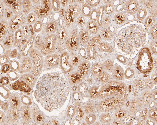 Paraformaldehyde-fixed, paraffin embedded Human kidney; Antigen retrieval by boiling in sodium citrate buffer (pH6.0) for 15min; Block endogenous peroxidase by 3% hydrogen peroxide for 20 minutes; Blocking buffer (normal goat serum) at 37°C for 30min; Antibody incubation with LPP Monoclonal Antibody, Unconjugated (bsm-54756R) at 1:50 for 30 minutes at room temperature, DAB staining.