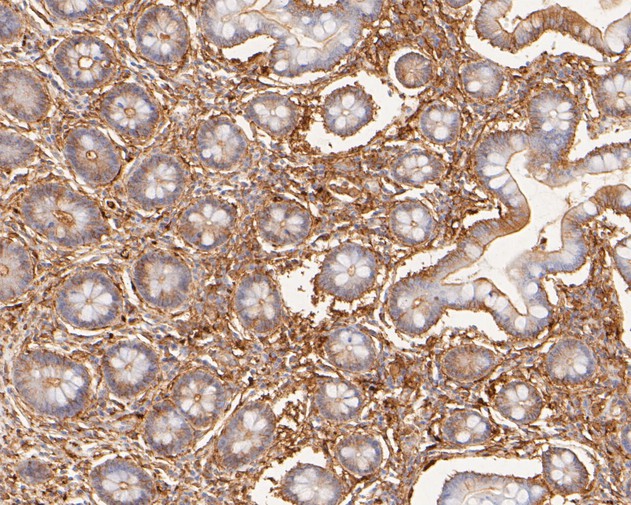 Paraformaldehyde-fixed, paraffin embedded Human intestine; Antigen retrieval by boiling in sodium citrate buffer (pH6.0) for 15min; Block endogenous peroxidase by 3% hydrogen peroxide for 20 minutes; Blocking buffer (normal goat serum) at 37°C for 30min; Antibody incubation with LPP Monoclonal Antibody, Unconjugated (bsm-54756R) at 1:50 for 30 minutes at room temperature, DAB staining.