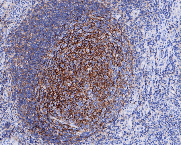 Paraformaldehyde-fixed, paraffin embedded Human tonsil; Antigen retrieval by boiling in sodium citrate buffer (pH6.0) for 15min; Block endogenous peroxidase by 3% hydrogen peroxide for 20 minutes; Blocking buffer (normal goat serum) at 37°C for 30min; Antibody incubation with CD35 Monoclonal Antibody, Unconjugated (bsm-54759R) at 1:50 for 30 minutes at room temperature, DAB staining.