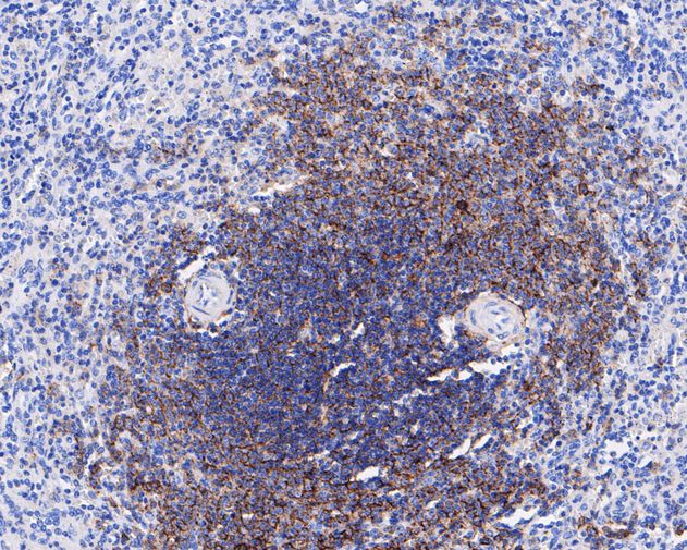 Paraformaldehyde-fixed, paraffin embedded Human spleen; Antigen retrieval by boiling in sodium citrate buffer (pH6.0) for 15min; Block endogenous peroxidase by 3% hydrogen peroxide for 20 minutes; Blocking buffer (normal goat serum) at 37°C for 30min; Antibody incubation with CD35 Monoclonal Antibody, Unconjugated (bsm-54759R) at 1:50 for 30 minutes at room temperature, DAB staining.