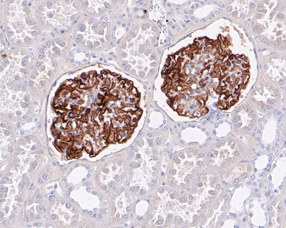 Paraformaldehyde-fixed, paraffin embedded Human kidney; Antigen retrieval by boiling in sodium citrate buffer (pH6.0) for 15min; Block endogenous peroxidase by 3% hydrogen peroxide for 20 minutes; Blocking buffer (normal goat serum) at 37°C for 30min; Antibody incubation with CD35 Monoclonal Antibody, Unconjugated (bsm-54759R) at 1:50 for 30 minutes at room temperature, DAB staining.