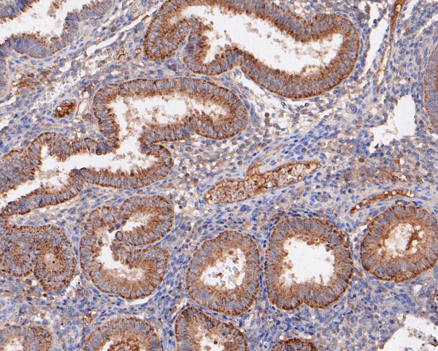 Paraformaldehyde-fixed, paraffin embedded Human uterus; Antigen retrieval by boiling in sodium citrate buffer (pH6.0) for 15min; Block endogenous peroxidase by 3% hydrogen peroxide for 20 minutes; Blocking buffer (normal goat serum) at 37°C for 30min; Antibody incubation with PLAP Monoclonal Antibody, Unconjugated (bsm-54760R) at 1:50 for 30 minutes at room temperature, DAB staining.