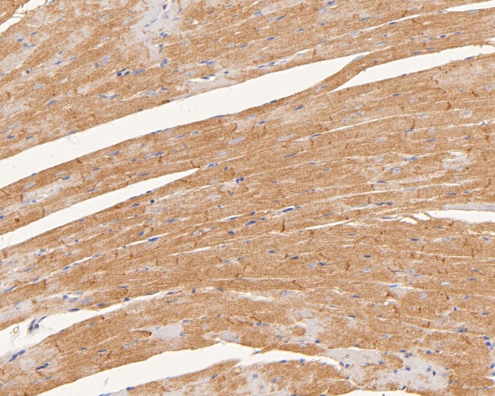 Paraformaldehyde-fixed, paraffin embedded Mouse heart; Antigen retrieval by boiling in sodium citrate buffer (pH6.0) for 15min; Block endogenous peroxidase by 3% hydrogen peroxide for 20 minutes; Blocking buffer (normal goat serum) at 37°C for 30min; Antibody incubation with CTNNA3 Monoclonal Antibody, Unconjugated (bsm-54761R) at 1:50 for 30 minutes at room temperature, DAB staining.