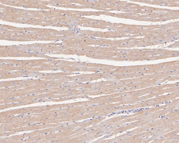 Paraformaldehyde-fixed, paraffin embedded Rat heart; Antigen retrieval by boiling in sodium citrate buffer (pH6.0) for 15min; Block endogenous peroxidase by 3% hydrogen peroxide for 20 minutes; Blocking buffer (normal goat serum) at 37°C for 30min; Antibody incubation with CTNNA3 Monoclonal Antibody, Unconjugated (bsm-54761R) at 1:50 for 30 minutes at room temperature, DAB staining.