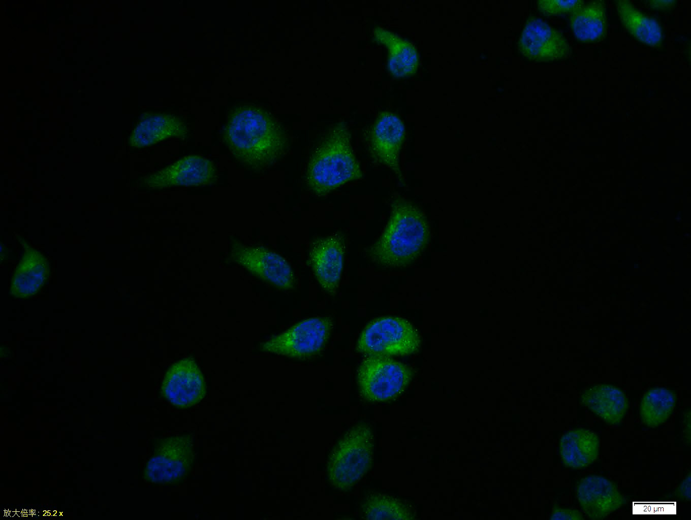 Hela cell; 4% Paraformaldehyde-fixed; Triton X-100 at room temperature for 20 min; Blocking buffer (normal goat serum, C-0005) at 37\u00b0C for 20 min; Antibody incubation with (IRAK1) polyclonal Antibody, Unconjugated (bs-6464R) 1:100, 90 minutes at 37\u00b0C; followed by a conjugated Goat Anti-Rabbit IgG antibody at 37\u00b0C for 90 minutes, DAPI (blue, C02-04002) was used to stain the cell nuclei.