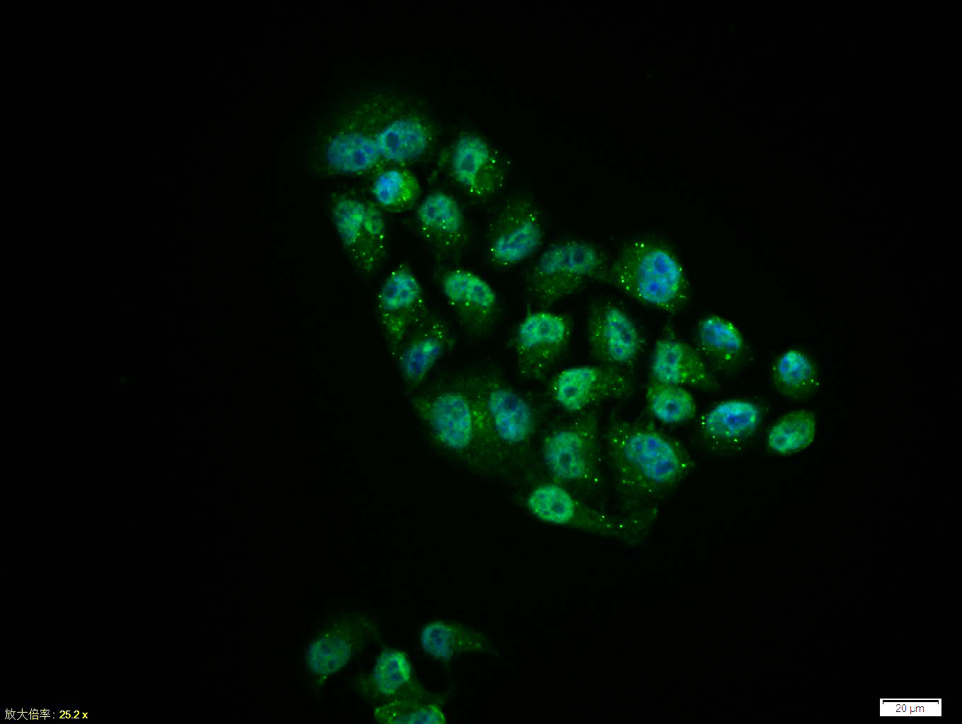 Hela cell; 4% Paraformaldehyde-fixed; Triton X-100 at room temperature for 20 min; Blocking buffer (normal goat serum, C-0005) at 37°C for 20 min; Antibody incubation with (phospho-EGFR (Ser1142)) polyclonal Antibody, Unconjugated (bs-5322R) 1:100, 90 minutes at 37°C; followed by a conjugated Goat Anti-Rabbit IgG antibody at 37°C for 90 minutes, DAPI (blue, C02-04002) was used to stain the cell nuclei.