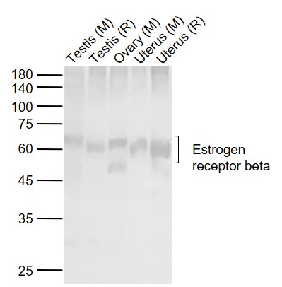 Lane 1: Mouse Testis lysates; Lane 2: Rat Testis lysates; Lane 3: Mouse Ovary lysates; Lane 4: Mouse Uterus lysates ; Lane 5: Rat Uterus lysates probed with Estrogen receptor beta Polyclonal Antibody, Unconjugated (bs-0116R) at 1:1000 dilution and 4˚C overnight incubation. Followed by conjugated secondary antibody incubation at 1:20000 for 60 min at 37˚C.