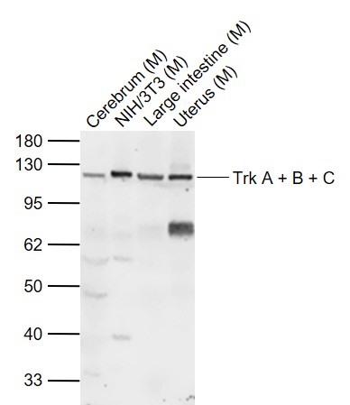 Lane 1: Mouse Cerebrum lysates; Lane 2: Mouse NIH/3T3 cell lysates; Lane 3: Mouse Large intestine lysates; Lane 4: Mouse Uterus lysates probed with Tyrosine Kinase Receptor Polyclonal Antibody, Unconjugated (bs-0192R) at 1:1000 dilution and 4˚C overnight incubation. Followed by conjugated secondary antibody incubation at 1:20000 for 60 min at 37˚C.