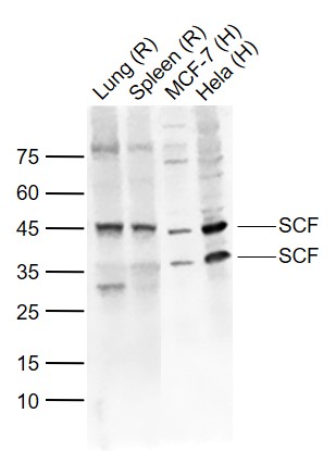 Lane 1: Mouse Lung lysates; Lane 2: Mouse Spleen lysates; Lane 3:Human MCF-7 cell lysates; Lane 4: Human Hela cell lysates probed with SCF Polyclonal Antibody, Unconjugated (bs-0545R) at 1:1000 dilution and 4˚C overnight incubation. Followed by conjugated secondary antibody incubation at 1:20000 for 60 min at 37˚C.