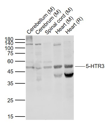 Lane 1: Mouse Cerebellum lysates; Lane 2: Mouse Cerebrum lysates; Lane 3: Mouse Spinal cord lysates; Lane 4: Mouse Heart lysates ; Lane 5: Rat Heart lysates probed with 5-HTR3/HTR3A Polyclonal Antibody, Unconjugated (bs-2126R) at 1:1000 dilution and 4˚C overnight incubation. Followed by conjugated secondary antibody incubation at 1:20000 for 60 min at 37˚C.