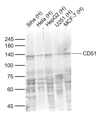 Lane 1: Human Siha cell lysates; Lane 2: Human Hela cell lysates; Lane 3: Human HepG2 cell lysates; Lane 4: Human U251 cell lysates ; Lane 5: Human MCF-7 cell lysates probed with Integrin alpha V\/CD51 Polyclonal Antibody, Unconjugated (bs-2250R) at 1:1000 dilution and 4˚C overnight incubation. Followed by conjugated secondary antibody incubation at 1:20000 for 60 min at 37˚C.
