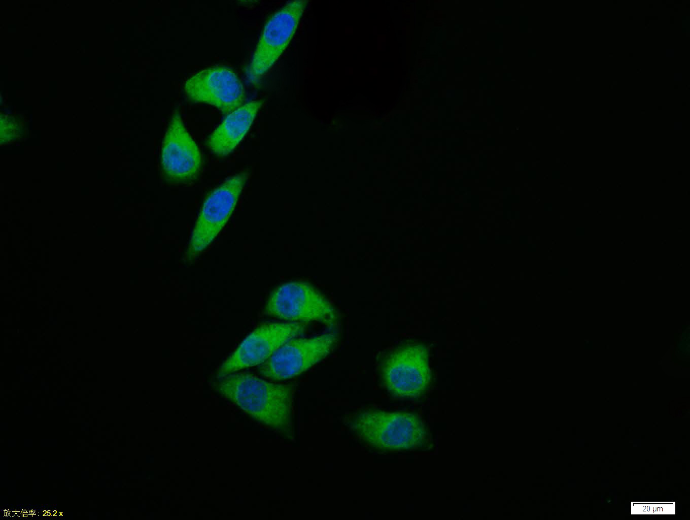 Hela cell; 4% Paraformaldehyde-fixed; Triton X-100 at room temperature for 20 min; Blocking buffer (normal goat serum, C-0005) at 37°C for 20 min; Antibody incubation with (JNK1 + JNK3) polyclonal Antibody, Unconjugated (bs-20759R) 1:100, 90 minutes at 37°C; followed by a conjugated Goat Anti-Rabbit IgG antibody at 37°C for 90 minutes, DAPI (blue, C02-04002) was used to stain the cell nuclei.