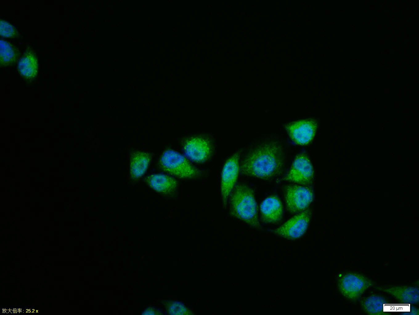 Hela cell; 4% Paraformaldehyde-fixed; Triton X-100 at room temperature for 20 min; Blocking buffer (normal goat serum, C-0005) at 37°C for 20 min; Antibody incubation with (JNK1 + JNK3) polyclonal Antibody, Unconjugated (bs-0501R) 1:100, 90 minutes at 37°C; followed by a conjugated Goat Anti-Rabbit IgG antibody at 37°C for 90 minutes, DAPI (blue, C02-04002) was used to stain the cell nuclei.