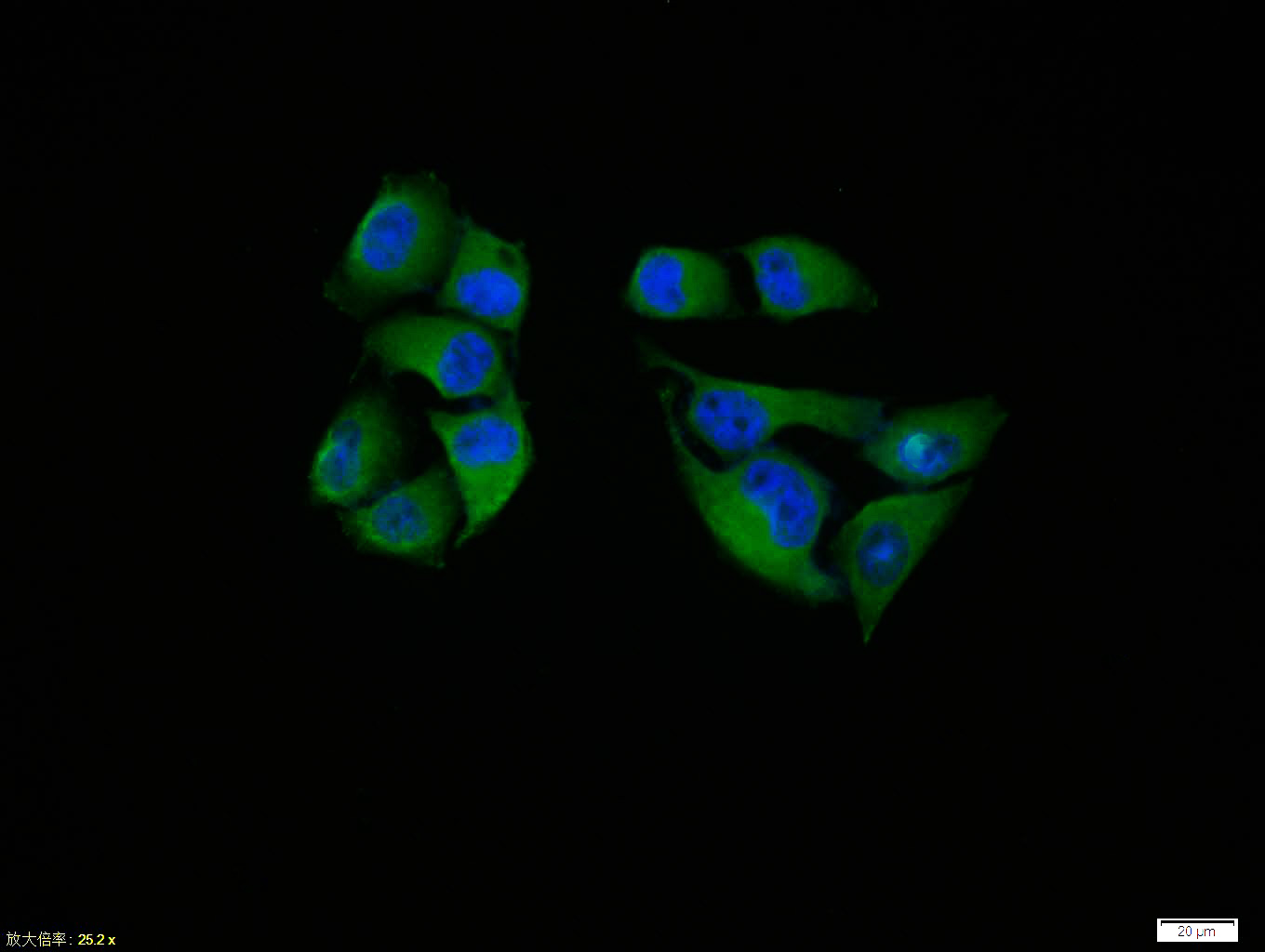 Hela cell; 4% Paraformaldehyde-fixed; Triton X-100 at room temperature for 20 min; Blocking buffer (normal goat serum, C-0005) at 37°C for 20 min; Antibody incubation with (PTEN) polyclonal Antibody, Unconjugated (bs-0748R) 1:100, 90 minutes at 37°C; followed by a conjugated Goat Anti-Rabbit IgG antibody at 37°C for 90 minutes, DAPI (blue, C02-04002) was used to stain the cell nuclei.